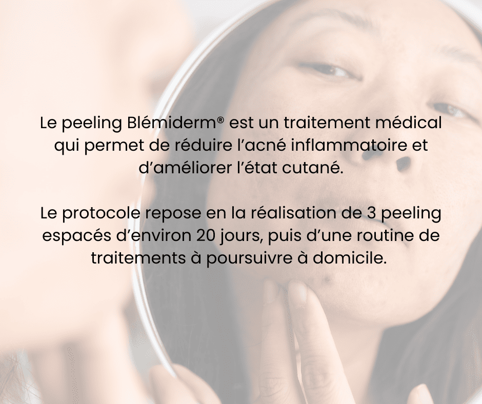 peeling blemiderm acn&eacute;