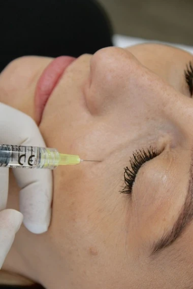 Hyperpigmentation péri-orbitaire | Traitement à La Clinique Laser
