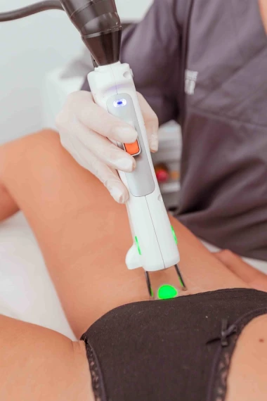 Epilation laser : les zones à traiter et à éviter
