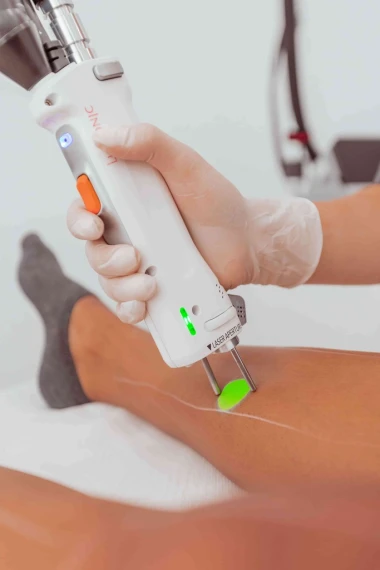 Lasers médecine esthétique | La Clinique Laser Marseille & Nice