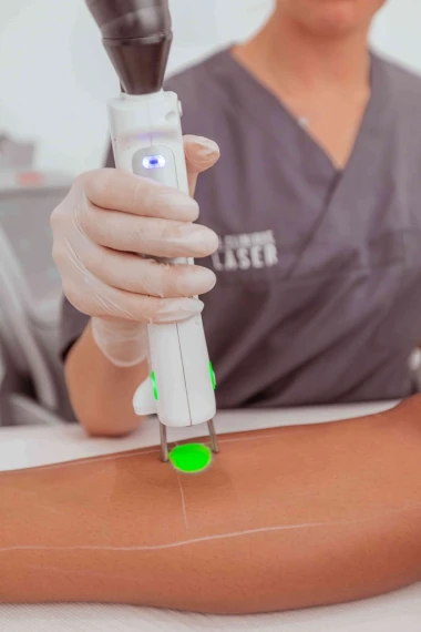 Choisir L' épilation au laser  ou lumière pulsée ?