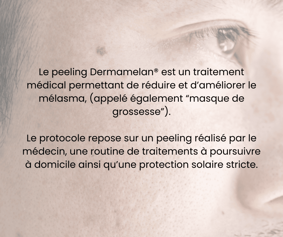 Descriptif melasma
