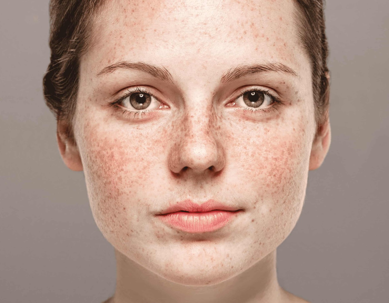 Causes et traitements du m&eacute;lasma